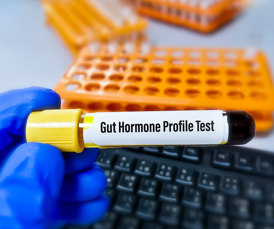 Hormone Profile Blood Testing in The UK