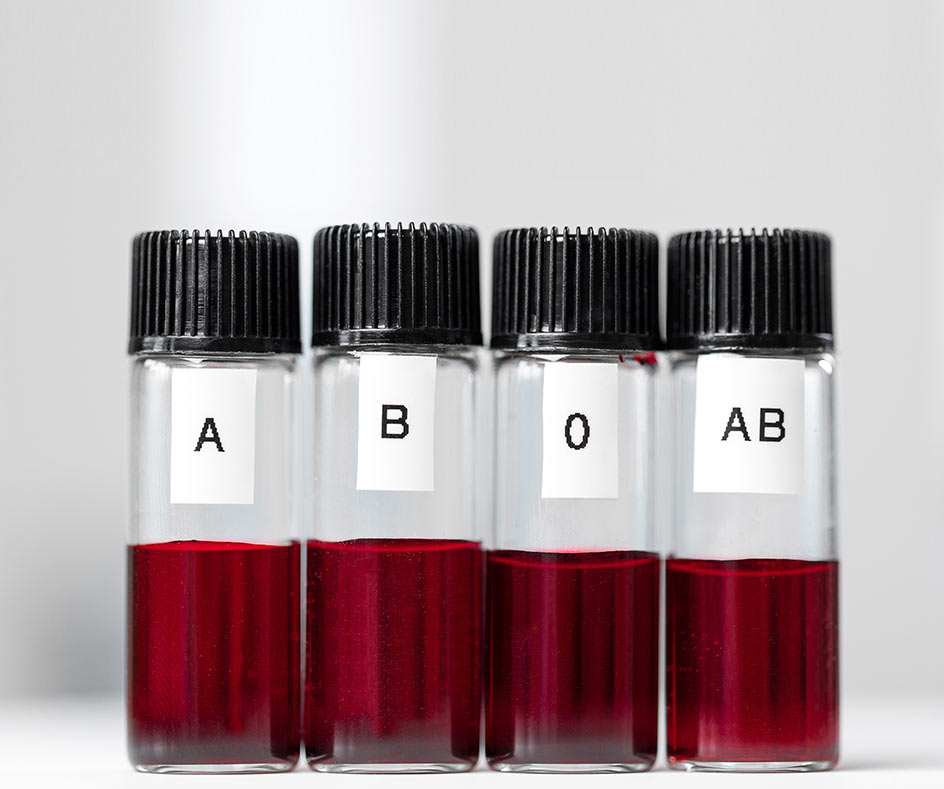 ABO blood grouping test London