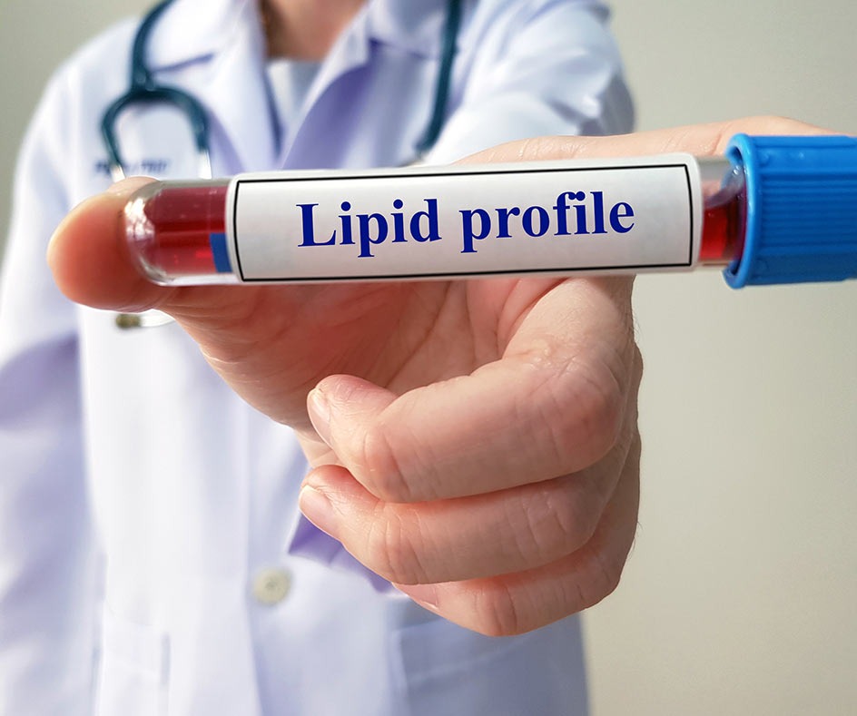 HPV Transmission RiskWhat is a lipid profile blood test