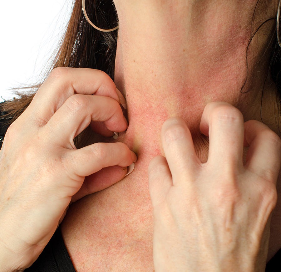 Different types of allergies