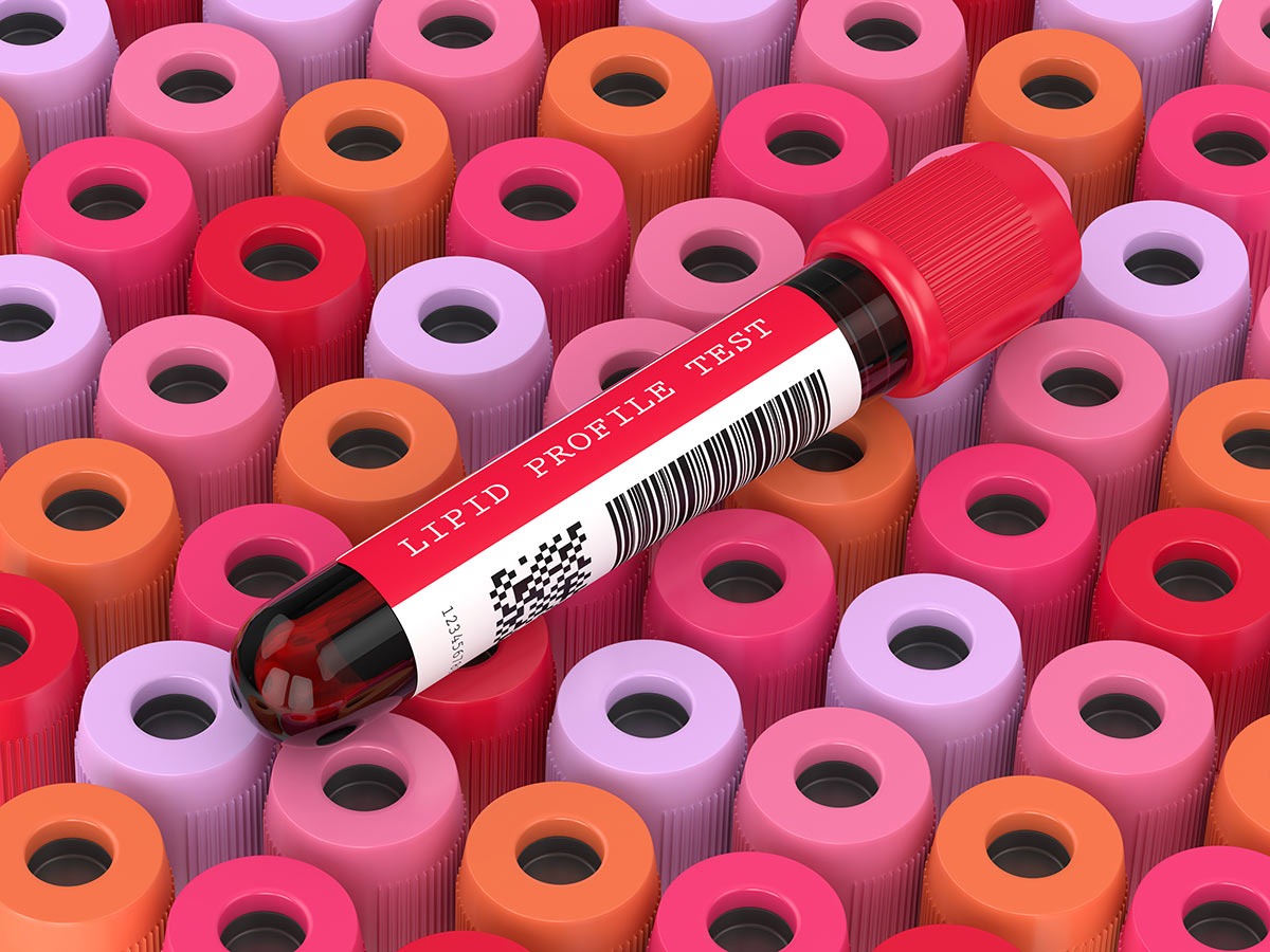 Before a lipid profile test