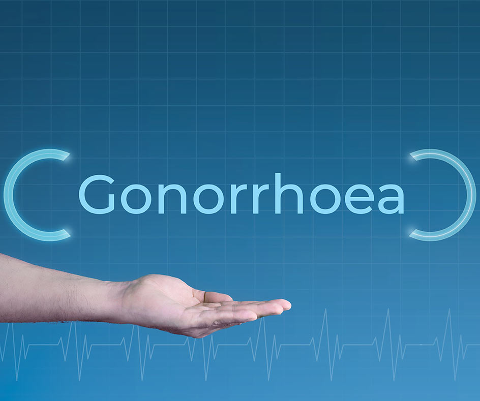 Procedure for Gonorrhoea testing in London