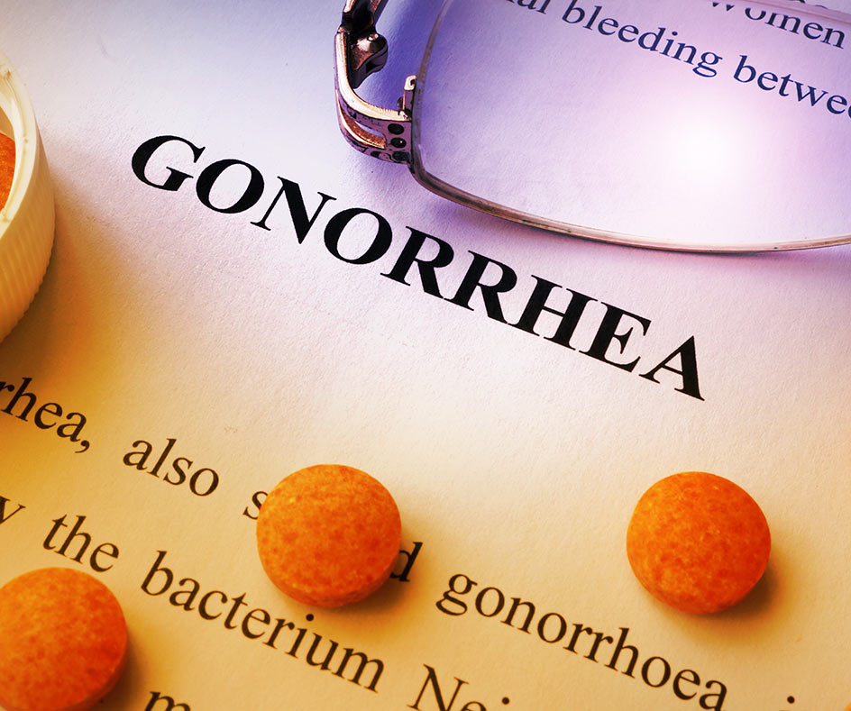 Gonorrhoea testing Results