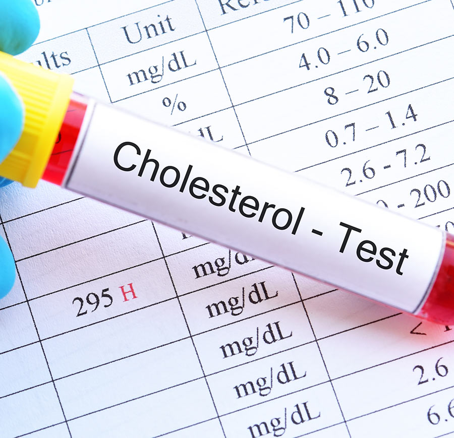 Cholesterol test results