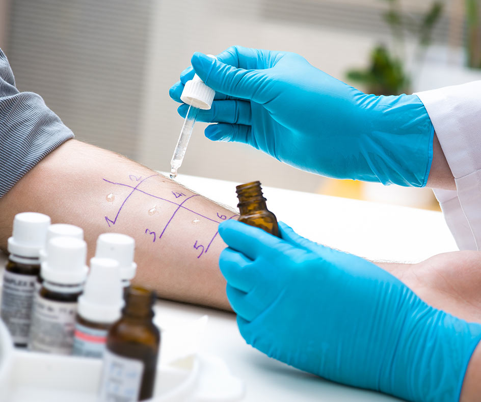 Our Clinic offers allergy testing in London
