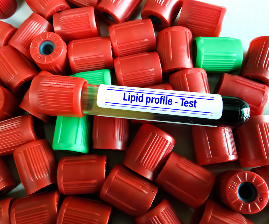 Managing abnormal lipid levels