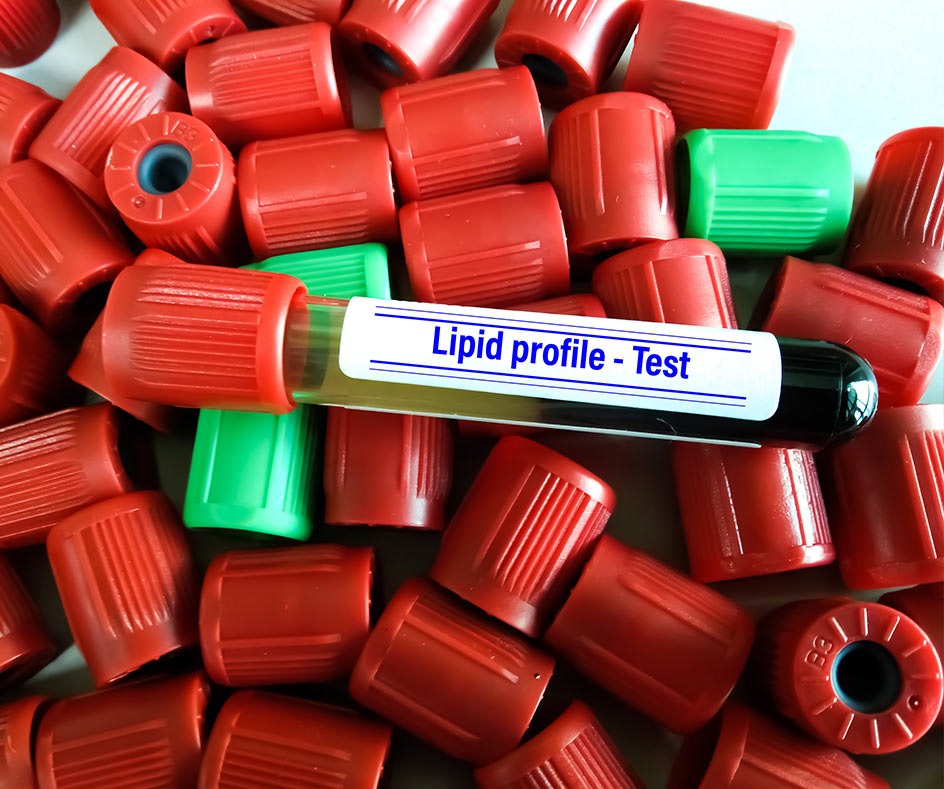 Managing abnormal lipid levels