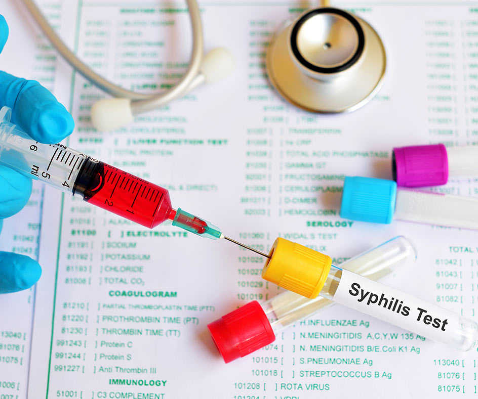 Causes of syphilis