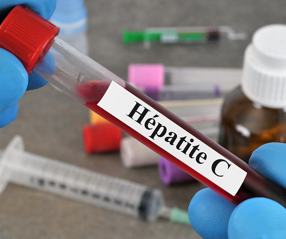 Cost of hepatitis test