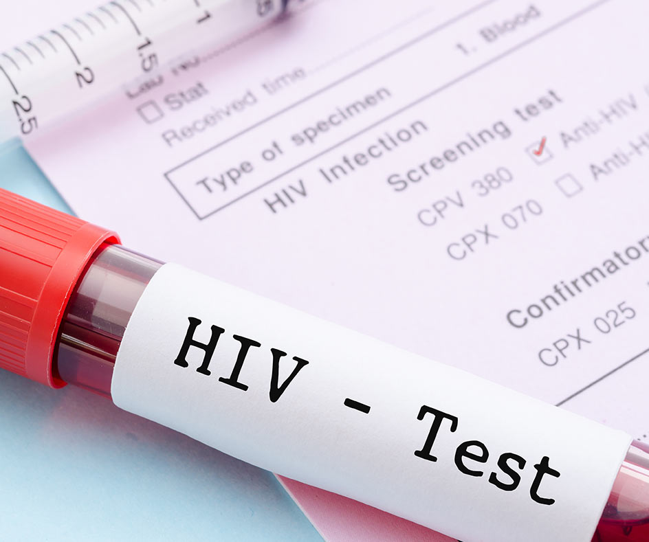 Taking a sample for Same day HIV testing in London Clinic