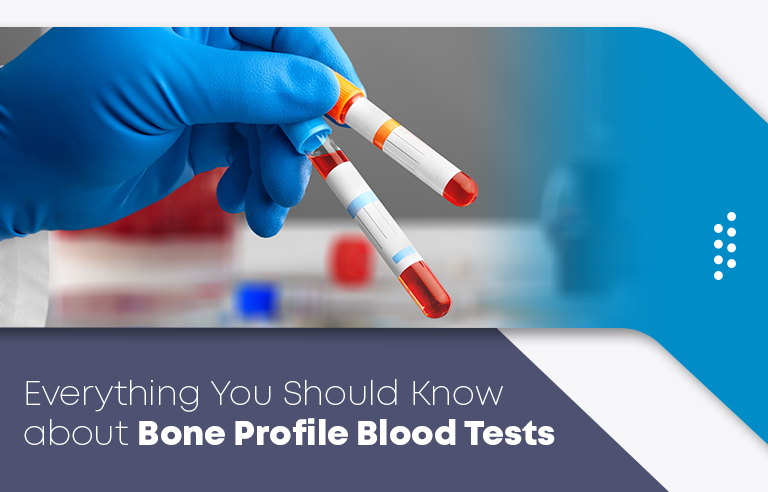 Everything You Should Know about Bone Profile Blood Tests